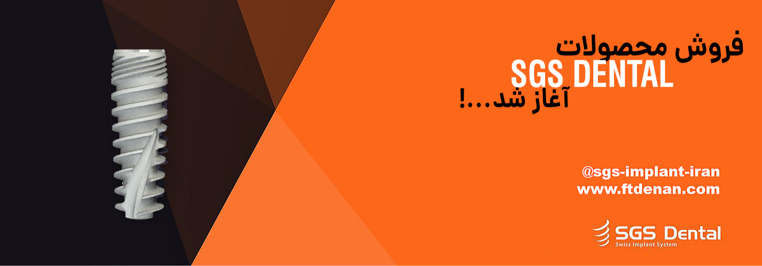 آغاز فروش SGS