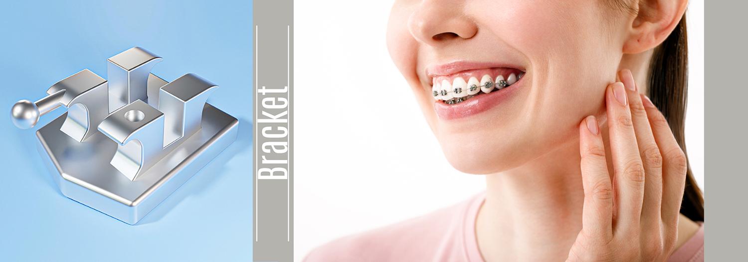 صفحه براکت‌ها