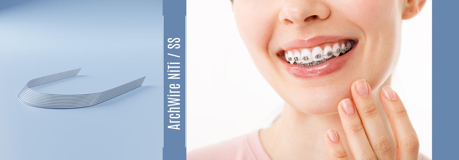 آرچ وایر آرچ وایر